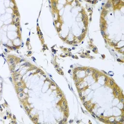 Anti-FBXL5 antibody used in IHC (Paraffin sections) (IHC-P). GTX32599