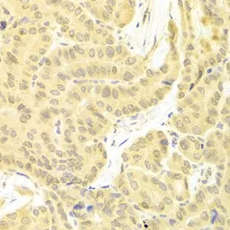 Anti-FLIP antibody used in IHC (Paraffin sections) (IHC-P). GTX32608