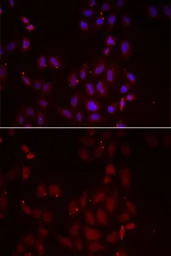 Anti-FRP-3 antibody used in Immunocytochemistry/ Immunofluorescence (ICC/IF). GTX32611