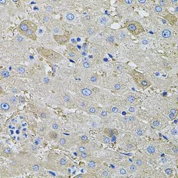 Anti-Galactosidase alpha antibody used in IHC (Paraffin sections) (IHC-P). GTX32617