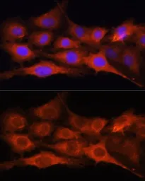 Anti-GALNS antibody used in Immunocytochemistry/ Immunofluorescence (ICC/IF). GTX32618
