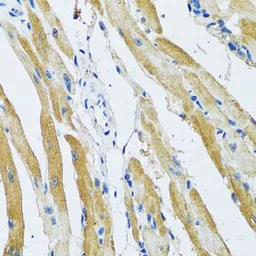 Anti-GDAP1 antibody used in IHC (Paraffin sections) (IHC-P). GTX32623