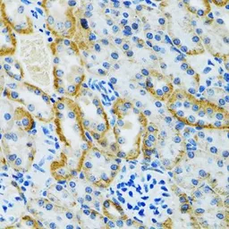 Anti-GDAP1 antibody used in IHC (Paraffin sections) (IHC-P). GTX32623