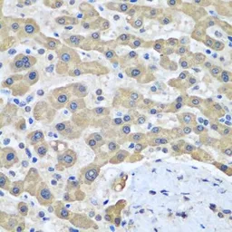 Anti-GFM1 antibody used in IHC (Paraffin sections) (IHC-P). GTX32625