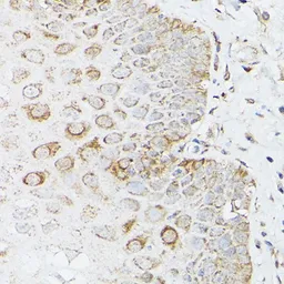 Anti-Glutamine synthetase antibody used in IHC (Paraffin sections) (IHC-P). GTX32627