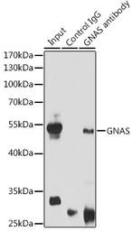 Anti-GNAS antibody used in Immunoprecipitation (IP). GTX32629