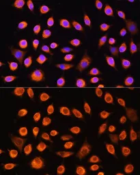 Anti-GNAS antibody used in Immunocytochemistry/ Immunofluorescence (ICC/IF). GTX32629