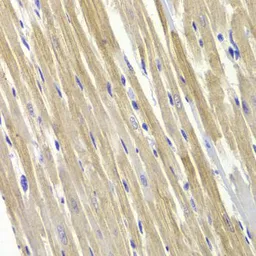 Anti-GPD1 antibody used in IHC (Paraffin sections) (IHC-P). GTX32630