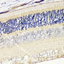 Anti-GRK1 antibody used in IHC (Paraffin sections) (IHC-P). GTX32635