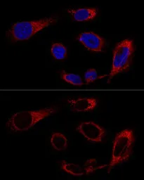 Anti-Grp78 antibody used in Immunocytochemistry/ Immunofluorescence (ICC/IF). GTX32636