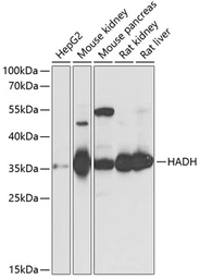 Anti-HADH antibody used in Western Blot (WB). GTX32641