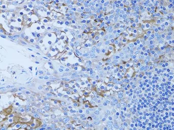 Anti-HADH antibody used in IHC (Paraffin sections) (IHC-P). GTX32641