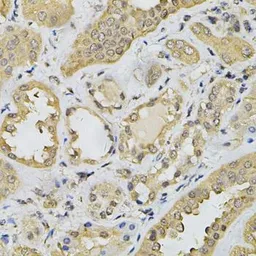 Anti-HEMK2 antibody used in IHC (Paraffin sections) (IHC-P). GTX32649