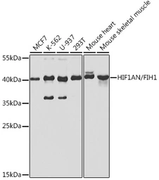 Anti-HIF1AN antibody used in Western Blot (WB). GTX32652