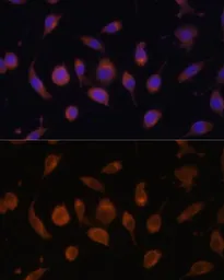 Anti-HIF1AN antibody used in Immunocytochemistry/ Immunofluorescence (ICC/IF). GTX32652