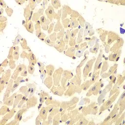 Anti-HIF1AN antibody used in IHC (Paraffin sections) (IHC-P). GTX32652
