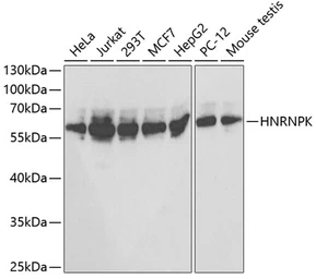 Anti-hnRNP K antibody used in Western Blot (WB). GTX32658