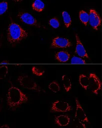 Anti-HSP60 antibody used in Immunocytochemistry/ Immunofluorescence (ICC/IF). GTX32661