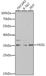 Anti-HUS1 antibody used in Western Blot (WB). GTX32662