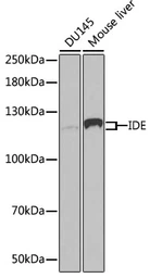 Anti-IDE antibody used in Western Blot (WB). GTX32665
