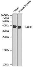 Anti-IL18BP antibody used in Western Blot (WB). GTX32676