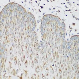 Anti-IMP3 antibody used in IHC (Paraffin sections) (IHC-P). GTX32680