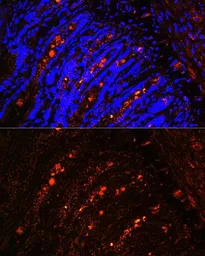 Anti-ITLN1 antibody used in IHC (Paraffin sections) (IHC-P). GTX32687