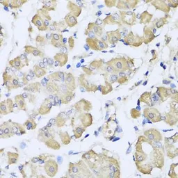 Anti-L2HGDH antibody used in IHC (Paraffin sections) (IHC-P). GTX32695