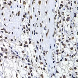 Anti-Macro H2A.1 antibody used in IHC (Paraffin sections) (IHC-P). GTX32709