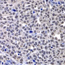 Anti-Macro H2A.1 antibody used in IHC (Paraffin sections) (IHC-P). GTX32709