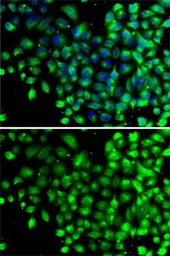 Anti-NAT5 antibody used in Immunocytochemistry/ Immunofluorescence (ICC/IF). GTX32736