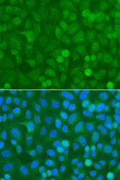Anti-NCK1 antibody used in Immunocytochemistry/ Immunofluorescence (ICC/IF). GTX32738