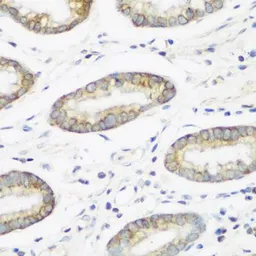 Anti-NEDD4 antibody used in IHC (Paraffin sections) (IHC-P). GTX32745