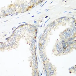 Anti-NEDD4 antibody used in IHC (Paraffin sections) (IHC-P). GTX32745