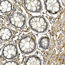 Anti-NGN3 antibody used in IHC (Paraffin sections) (IHC-P). GTX32747