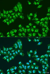 Anti-Nuclear Matrix Protein p84 antibody used in Immunocytochemistry/ Immunofluorescence (ICC/IF). GTX32757