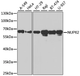 Anti-Nucleoporin p62 antibody used in Western Blot (WB). GTX32758