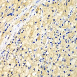 Anti-Nucleoporin p62 antibody used in IHC (Paraffin sections) (IHC-P). GTX32758