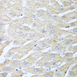 Anti-NUDT15 antibody used in IHC (Paraffin sections) (IHC-P). GTX32759