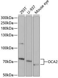 Anti-OCA2 antibody used in Western Blot (WB). GTX32764