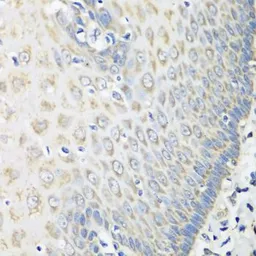 Anti-OXCT1 antibody used in IHC (Paraffin sections) (IHC-P). GTX32770
