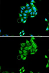 Anti-PHF17 antibody used in Immunocytochemistry/ Immunofluorescence (ICC/IF). GTX32786