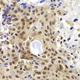 Anti-PHF19 antibody used in IHC (Paraffin sections) (IHC-P). GTX32787