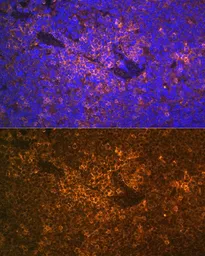 Anti-S100A12 antibody used in IHC (Paraffin sections) (IHC-P). GTX32854