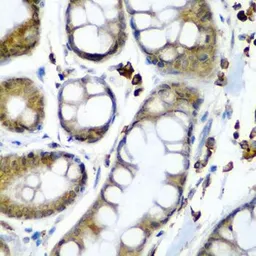 Anti-SBP2 antibody used in IHC (Paraffin sections) (IHC-P). GTX32857