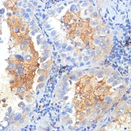 Anti-SEMA4C antibody used in IHC (Paraffin sections) (IHC-P). GTX32865