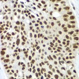 Anti-SF3B2 antibody used in IHC (Paraffin sections) (IHC-P). GTX32869