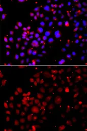 Anti-SLUG antibody used in Immunocytochemistry/ Immunofluorescence (ICC/IF). GTX32879