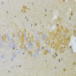 Anti-SLUG antibody used in IHC (Paraffin sections) (IHC-P). GTX32879