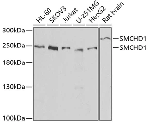 Anti-SMCHD1 antibody used in Western Blot (WB). GTX32883